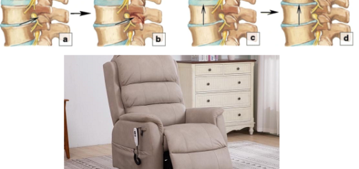 Recliners for Degenerative Disc Disease